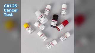 CA125 ELISA-Test zur Krebsüberwachung