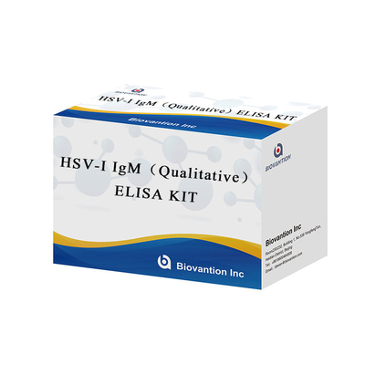 Labor- oder Krankenhaus-Hochpräzisionsanweisungen für die Verwendung des HSV-I IgG-ELISA-Testkits