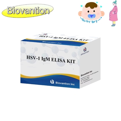 Torch ELISA Test Kit HSV 1 IgM Hochverkäuflich Diagnose-Reagent IVD