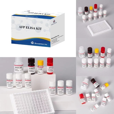 AFP-Alpha-Fetoprotein-Elisa-Test-Kit Enzymgebundene Produkte Kurze Transportzeit