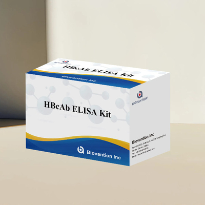 HBcAb ELISA-Test-Kit Antikörperdetektions-Kit Qualitativ