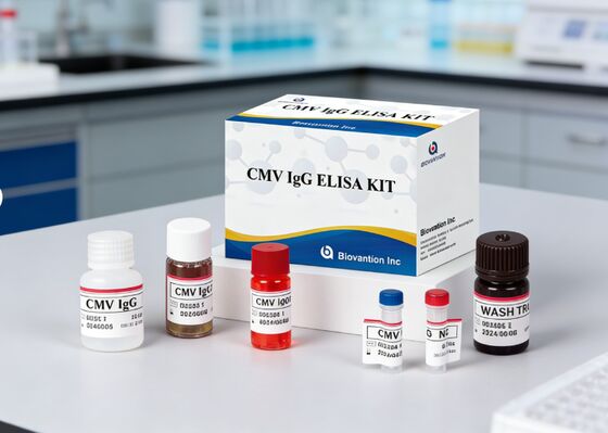 Im Labor oder im Krankenhaus eingesetztes hochgenaues CMV-IgG-Elisa-Testgerät