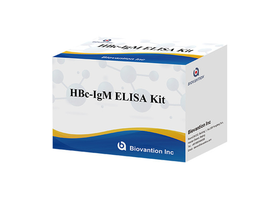 Test-Kit Hepatitiss B ISO13485 HBc IgM Kern-Antikörper Igm-Test