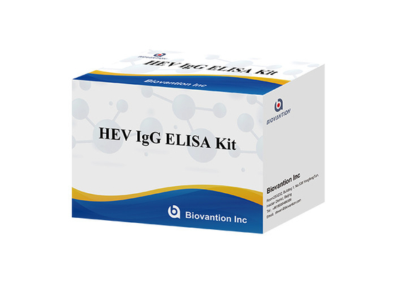 Menschlicher Igg Elisa Kit Diagnostic For IgG Antikörper HEV dem Virus zur Hepatitis-E