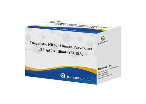 Diagnosekit für menschliches Parvovirus B19 IgG-Elisa-Testkit Antikörper für Serumproben