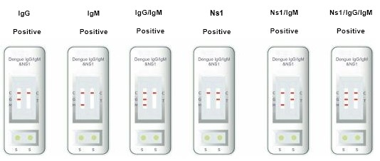 Krankenhaus, Medizinisches Zentrum, Selbst-Hochgenauigkeit-Einschritt-Dengue-IgG- und IgM-Test-Kit