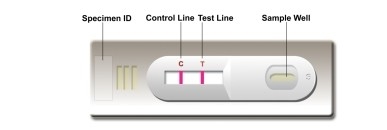Labor- oder Krankenhaus-Selbsttest Hochgenauigkeit Leishmania Ab Combo Rapid Test