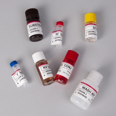 RV-G Elisa Testkit für die Diagnose der Plasmaprobentyp