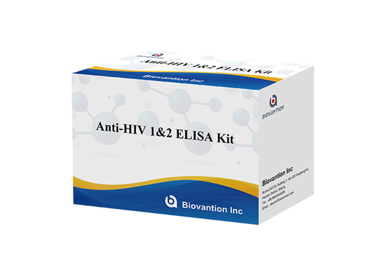 HIV Elisa Test Kit Haltbarkeitsdauer 18 Monate Elisa Test mit hoher Empfindlichkeit und Spezifität