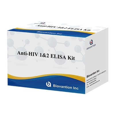 HIV Elisa Test Kit Haltbarkeitsdauer 18 Monate Elisa Test mit hoher Empfindlichkeit und Spezifität