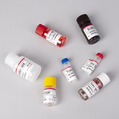 Krankenhäuser Laboratorien Kliniken verwenden hochgenaue Toxo IgM ELISA TEST KIT