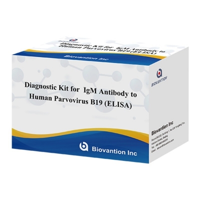 Diagnosepaket für den menschlichen Parvovirus B19 IgM-Antikörper Elisa Test-Kit mit 96T