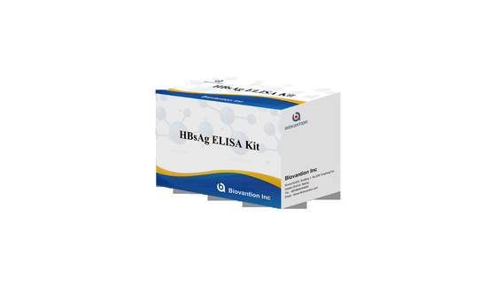 HBsAg ELISA-Testkit Qualitative Bestimmung des HBsAg-Virus