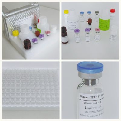 Serum Plasma TB-IGRA