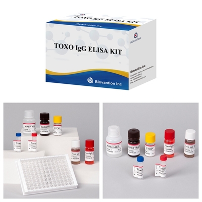 TOXO Ig G Empfindliches und spezifisches Elisa-Test-Kit für die Krankheitsüberwachung