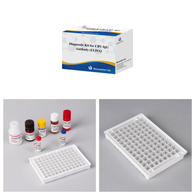 Empfindlichkeitsdiagnostisches Kit für CBV-IgG-Antikörper menschliche Erkennung Elisa-Kits für präzise Probentypenerkennung