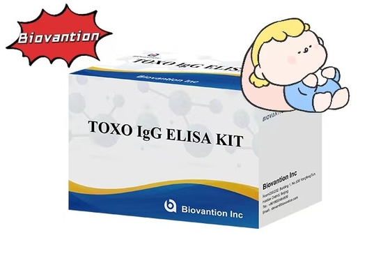Hochempfindlichkeit von Torch TOXO IgG ELISA Test Kit Krankenhaus-Test Schwangerschaftsprüfung