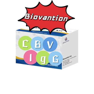 Diagnose-Kit für CBV-IgG-Antikörper ELISA-Test-Kit Serum-Test-Kit