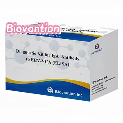High Sensitivity EBV VCA IgA ELISA Kit für die medizinische Diagnose mit 50 μl Serumprobe