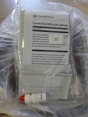 Epstein Barr EB-IgM-Antikörper-Schnelltest-Kassette Serum-Schnelltests