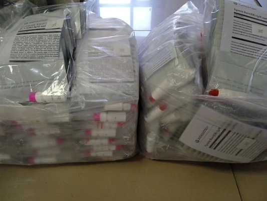 Epstein Barr EB-IgM-Antikörper-Schnelltest-Kassette Serum-Schnelltests