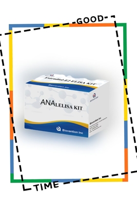 Anti-ANA IgG ELISA-Test-Kit Anti-Kern-IgG-Antikörper qualitative Detektion