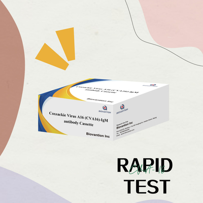 Coxsackie-Virus A16 CVA16-IgM Antikörper-Kassette WB/S/P Kolloidgold-Schnelltest