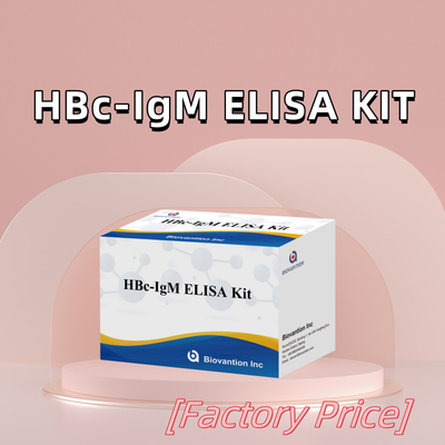 Hochgenaue HBc IgM-Anthgen-Diagnostikreagenten-Test mit enzymgebundenem Immunosorbenten-Test-Kit