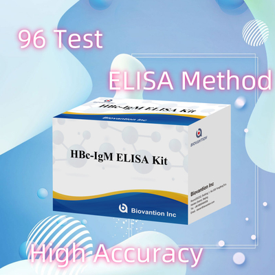 Hochgenaue HBc IgM-Anthgen-Diagnostikreagenten-Test mit enzymgebundenem Immunosorbenten-Test-Kit