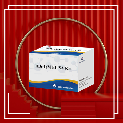 Hochgenaue HBc IgM-Anthgen-Diagnostikreagenten-Test mit enzymgebundenem Immunosorbenten-Test-Kit