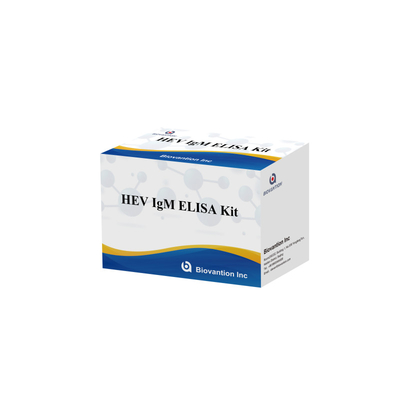 Genaues und empfindliches Elisa-Test-Kit HEV-IgM zur Diagnose und Analyse