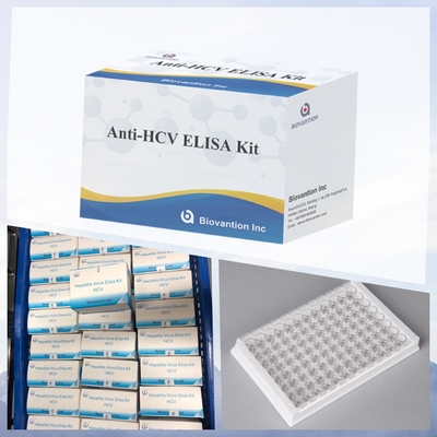 Neue Ankunft IVD-Reagent HCV-Diagnostischer Reagent-Test für das menschliche Krankenhaus-Klinikum