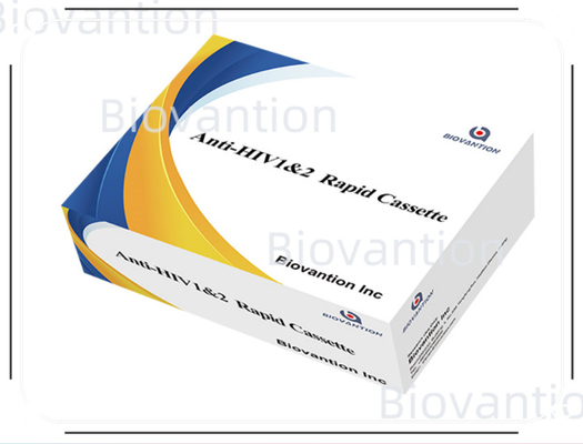 Rapid Test Reagenz HIV 1/2 Nachweisversuch Kolloidgoldmethode mit 25 Tests