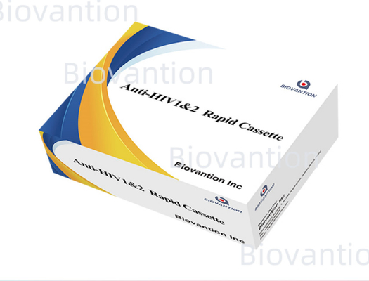 Rapid Test Reagenz HIV 1/2 Nachweisversuch Kolloidgoldmethode mit 25 Tests