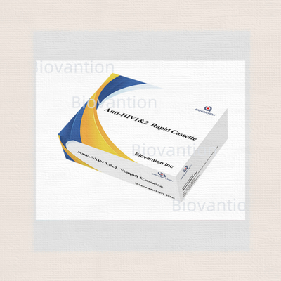 Rapid Test Reagenz HIV 1/2 Nachweisversuch Kolloidgoldmethode mit 25 Tests