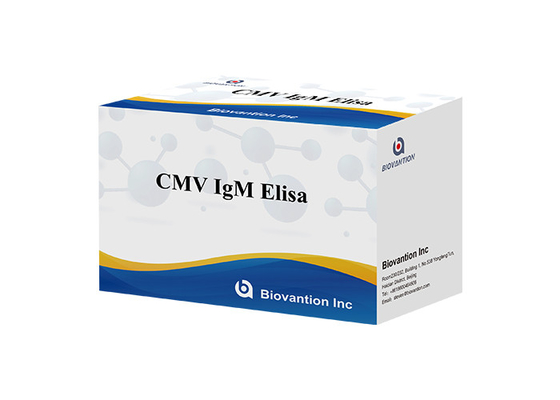 cMV IgM Elisa-Test-Kit für die Enzym-gebundene Immunosorbentenanalyse