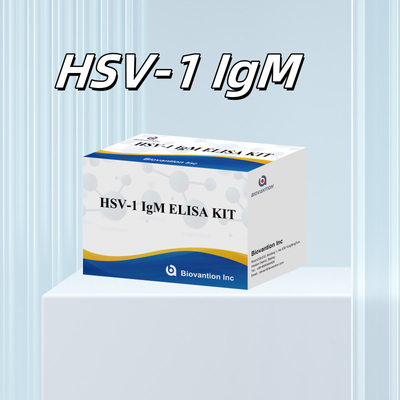 HSV-1 IgM Medizinische Diagnose Elisa Testkit mit 18 Monaten Haltbarkeit Ursprung