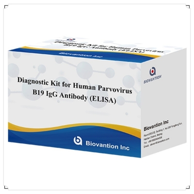 Fabrik-Direktverkauf B19 ELISA-Kit für menschliche Parvovirus-B19 IgM-Antikörper Elisa-Test-Kit mit 96T