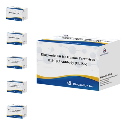Fabrik-Direktverkauf B19 ELISA-Kit für menschliche Parvovirus-B19 IgM-Antikörper Elisa-Test-Kit mit 96T