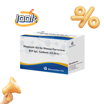 Fabrik-Direktverkauf B19 ELISA-Kit für menschliche Parvovirus-B19 IgM-Antikörper Elisa-Test-Kit mit 96T