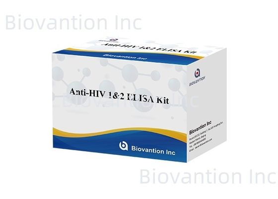 Biovantion Anti-HIV ELISA-Test-Kit Vierte Generation für die HIV-1- und HIV-2-Prüfung