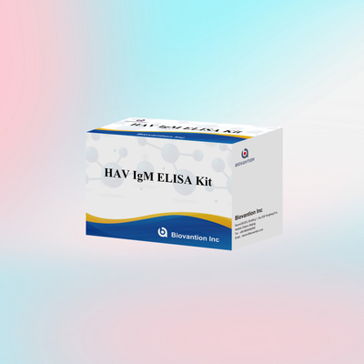 HAV IgM ELISA-Test-Kit für menschliche Diagnosereagenzien