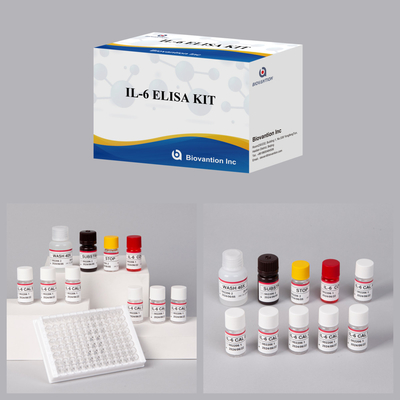 IL6 Interleukin-6 für den menschlichen Elisa-Detector Reagent Elisa Analyzer Forschung