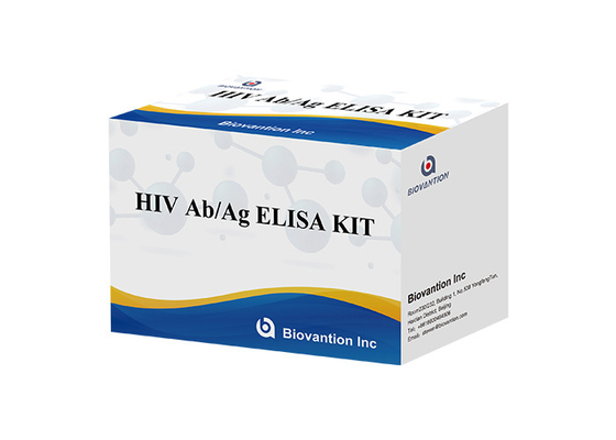 HIV-Antikörper/Antigen-ELISA-Test-Kit für das Human Immunschwäche-Virus