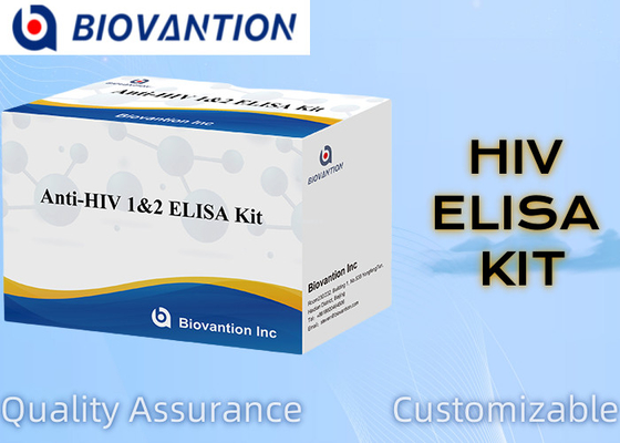 Advanced Anti-HIV ELISA1/2 Testkit für die sensible und spezifische Analyse neurologischer Erkrankungen