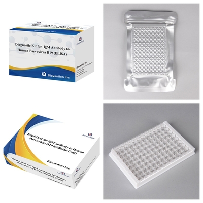 Advanced Human Parvovirus B19 IgM Antikörper-ELISA-Test-Kit zur Schwangerschaftserkennung und -untersuchung