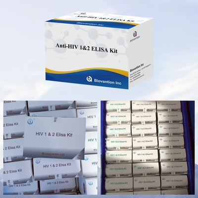 Schnelle und einfache HIV-ELISA-Testkiste für schnelle und bequeme Erkennung der Krankheit