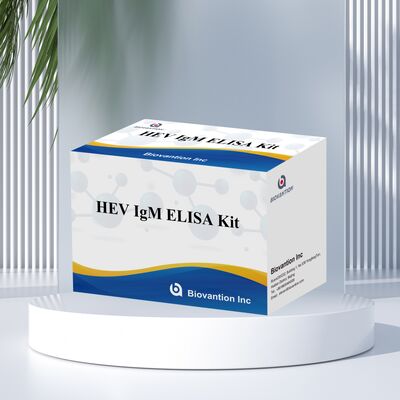 High Sensitivity HEV IgM Elisa Test Kit mit 96T Größe und 2-3 Stunden Testzeit für eine genaue Diagnose