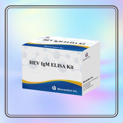 High Sensitivity HEV IgM Elisa Test Kit mit 96T Größe und 2-3 Stunden Testzeit für eine genaue Diagnose
