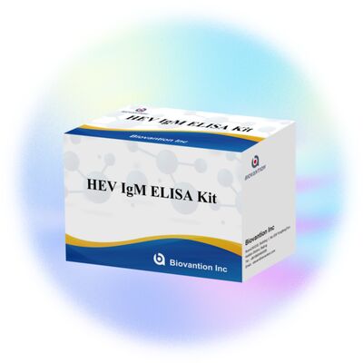 High Sensitivity HEV IgM Elisa Test Kit mit 96T Größe und 2-3 Stunden Testzeit für eine genaue Diagnose